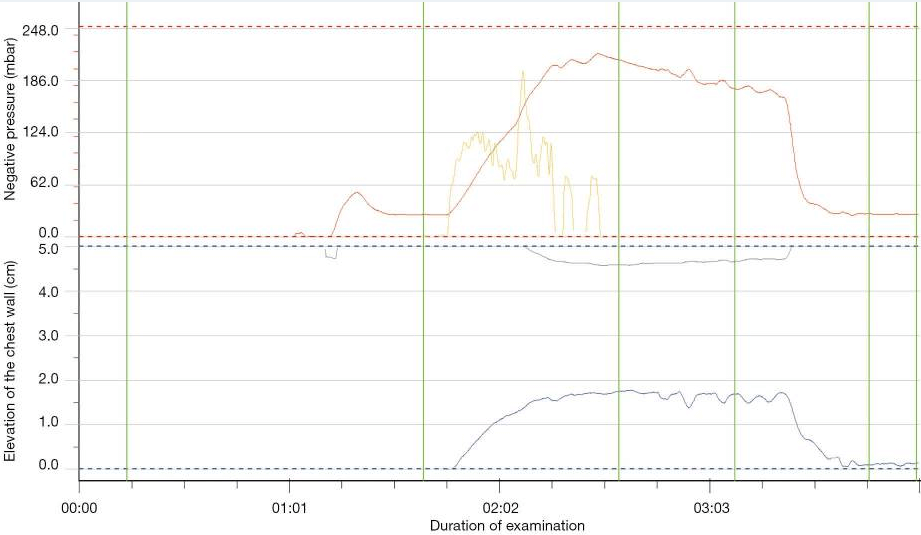How to use a vacuum bell